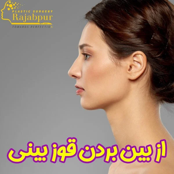از بین بردن قوز بینی + دکتر رجب پور