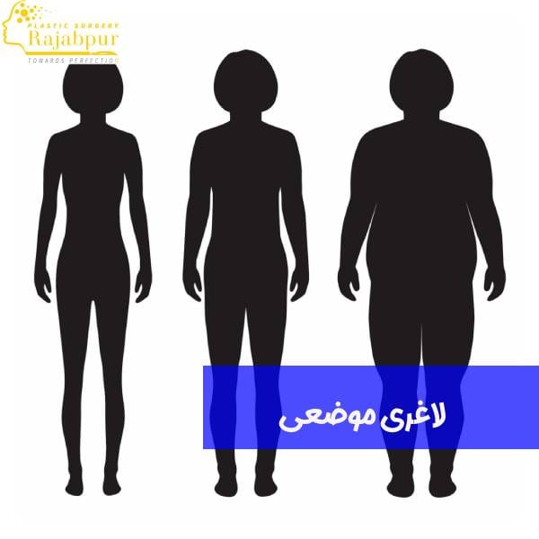 لاغری موضعی