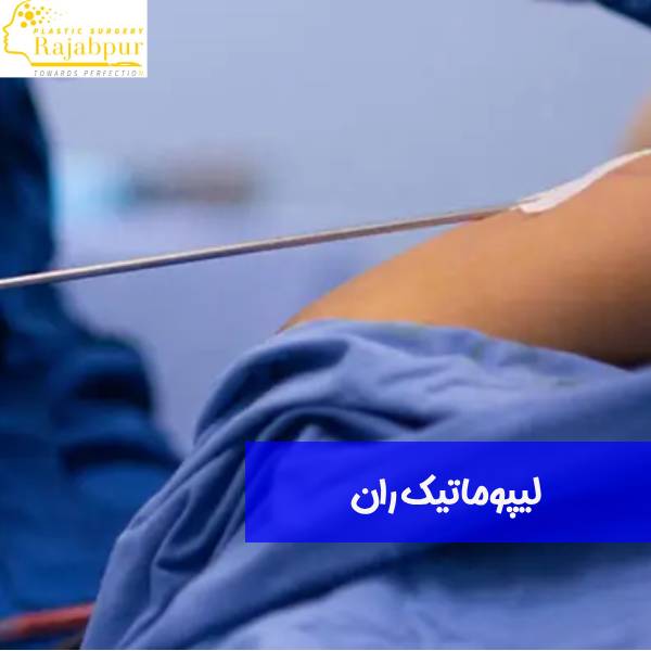 لیپوماتیک ران