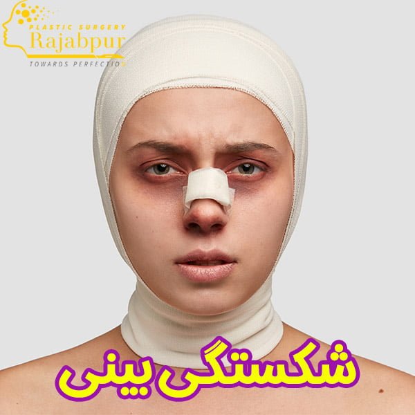 شکستگی بینی + دکتر رجب پور