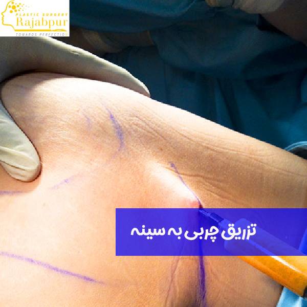 عکس تزریق چربی به سینه