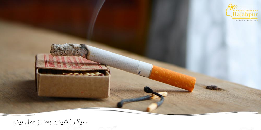 سیگار بعد عمل بینی - دکتر رجب پور
