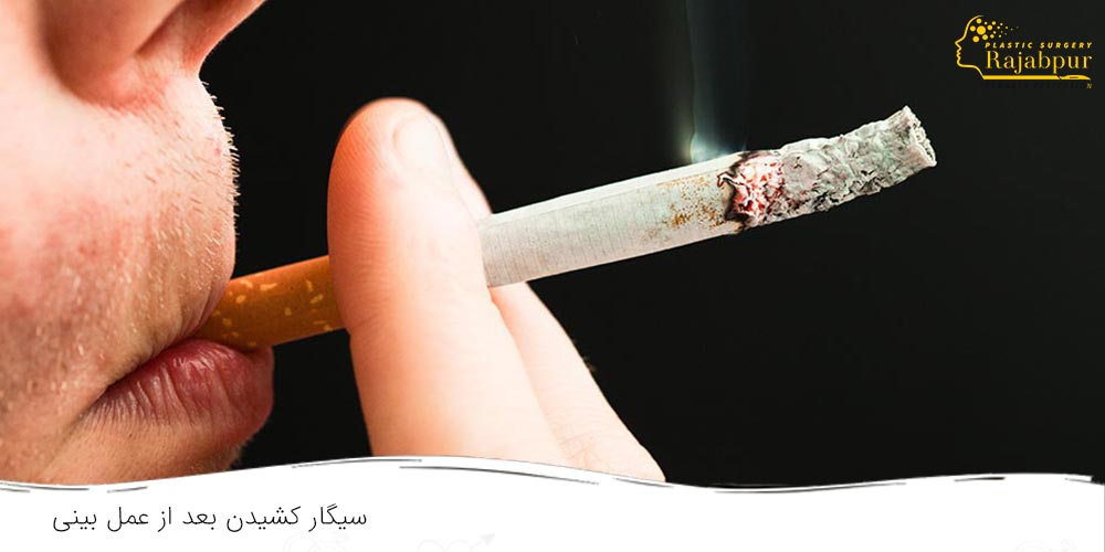 سیگار کشیدن بعد از عمل بینی