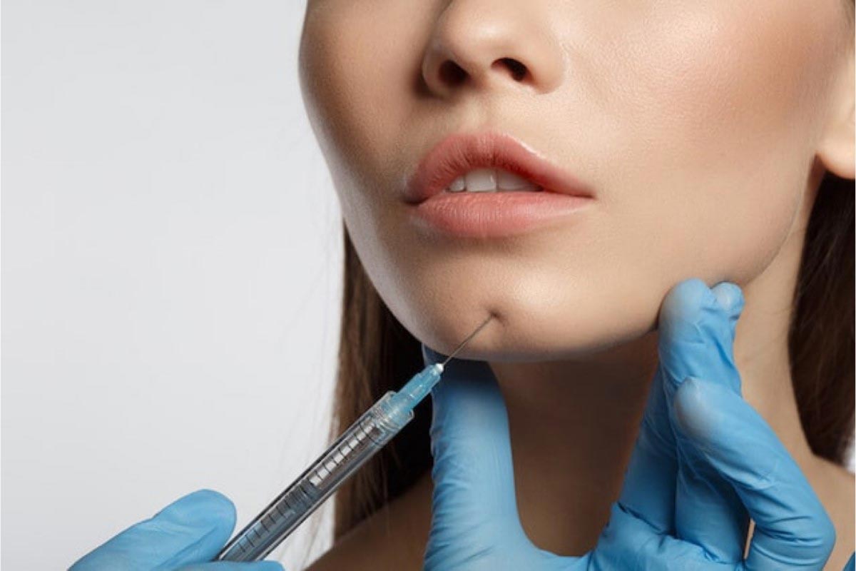 بوتاکس چانه