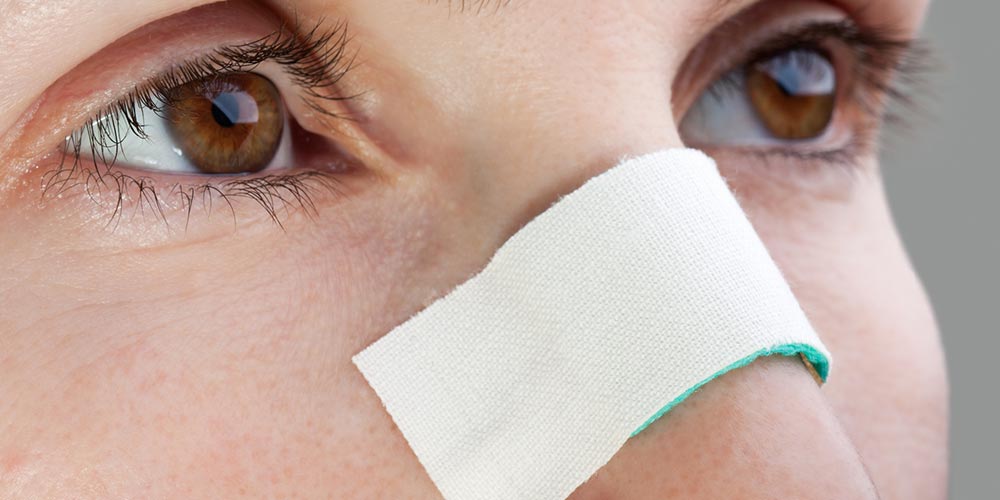 عوارض چسب زدن طولانی مدت بینی