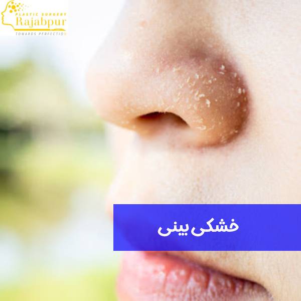 خشکی بینی بعد از عمل