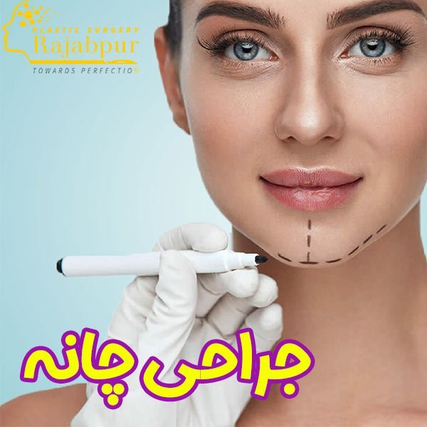 جراحی چانه + دکتر رجب پور