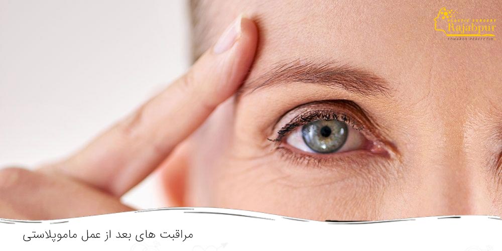 مراقبت های بعد از جراحی افتادگی پلک