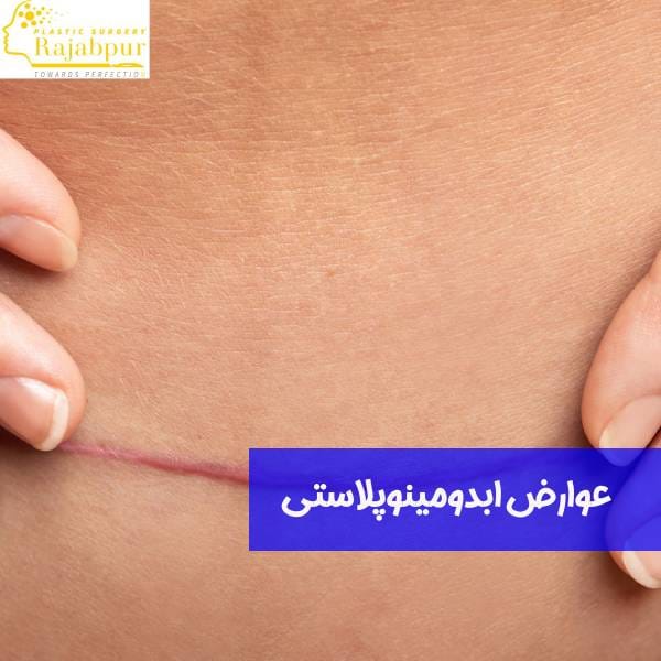 عکس عوارض ابدومینوپلاستی