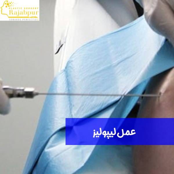 عمل لیپولیز
