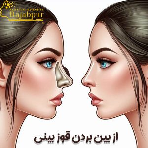 از بین بردن قوز بینی - دکتر رجبپور