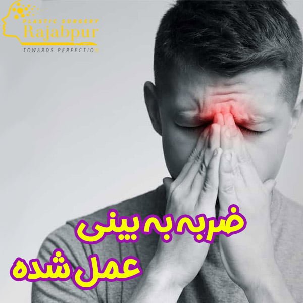 ضربه به بینی عمل شده + دکتر رجب پور