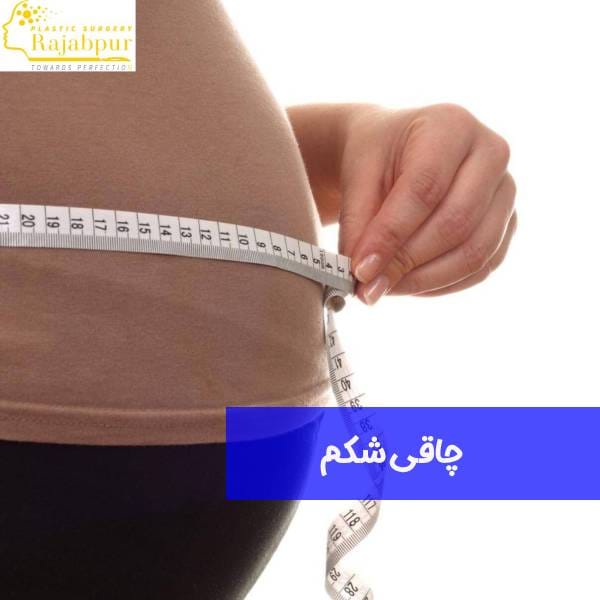چاقی شکم