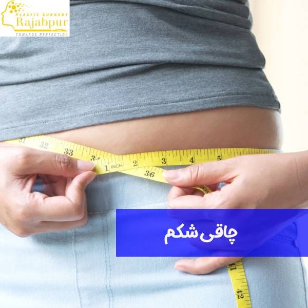 چاقی شکم