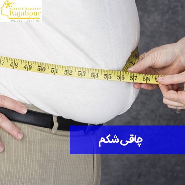 چاقی شکم