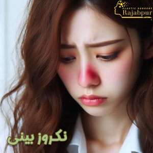 نکروز بینی - دکتر رجب پور