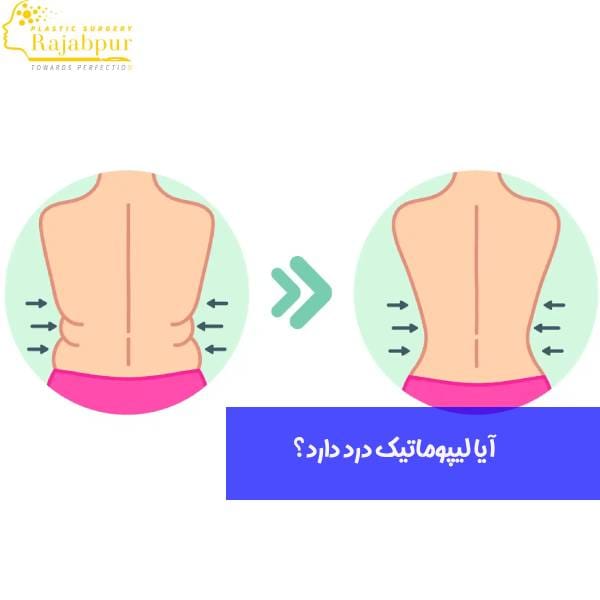 درد لیپوماتیک