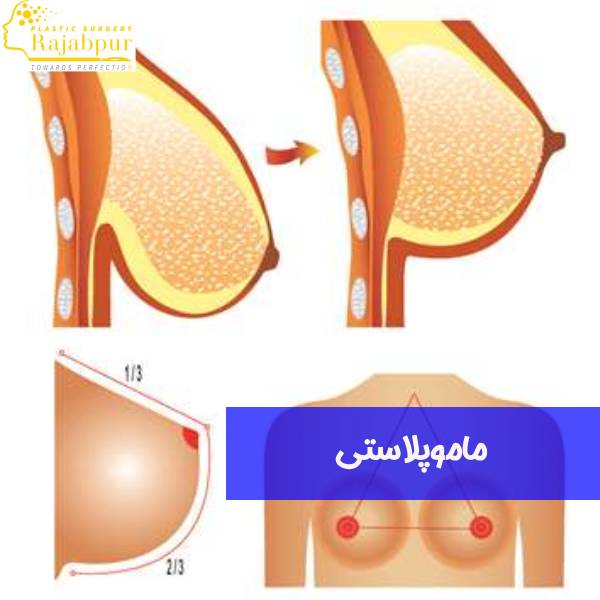 عکس کوچک کردن سینه