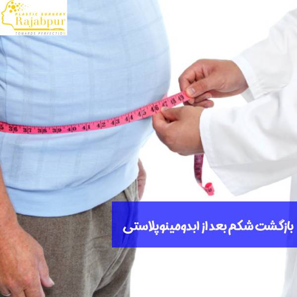 بازگشت شکم بعد از ابدومینوپلاستی