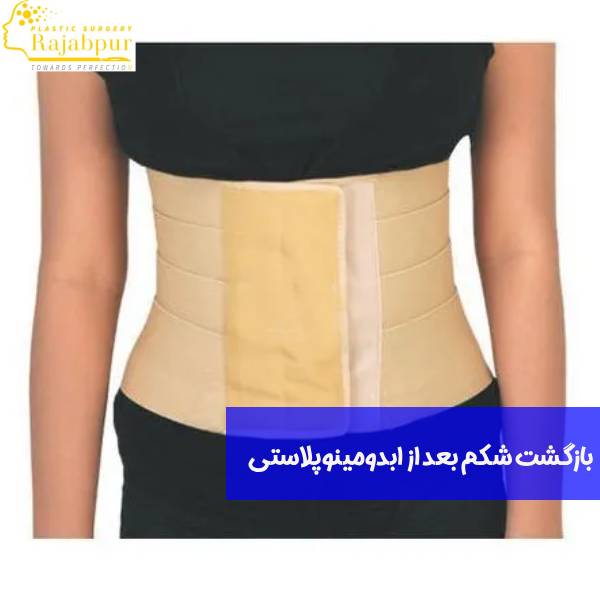 برگشت شکم بعد از ابدومینوپلاستی