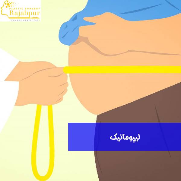 عکس لیپوماتیک