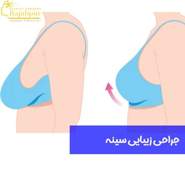 عمل زیبایی سینه