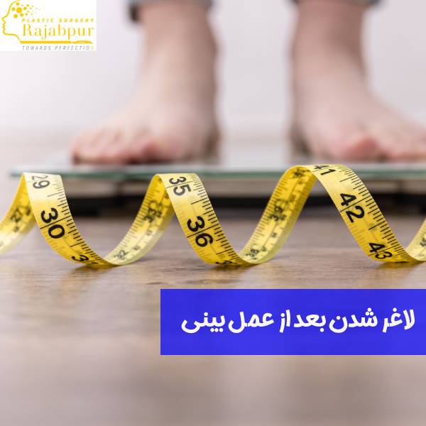لاغری بعد از عمل بینی