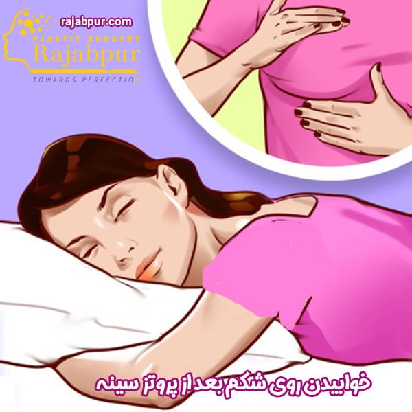 خوابیدن روی شکم بعد از پروتز سینه