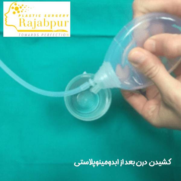 کشیدن درن بعد از ابدومینوپلاستی