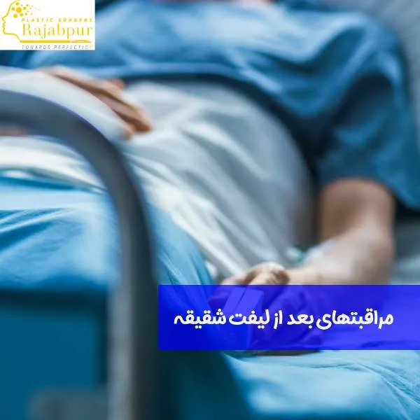 مراقبت های بعد از لیفت شقیقه