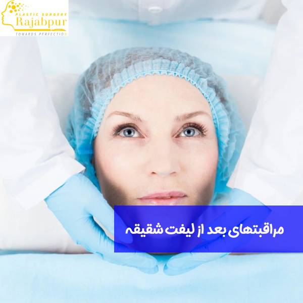 دوره نقاهت بعد از لیفت شقیقه