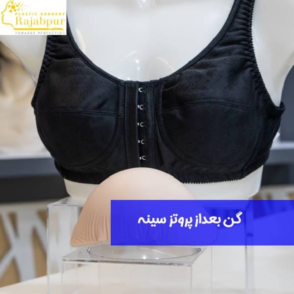 گن بعد از پروتز سینه