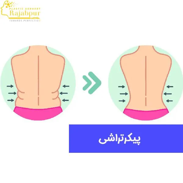 عکس پیکرتراشی
