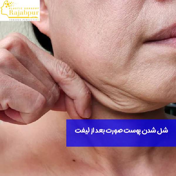 شل شدن پوست صورت بعد از لیفتینگ