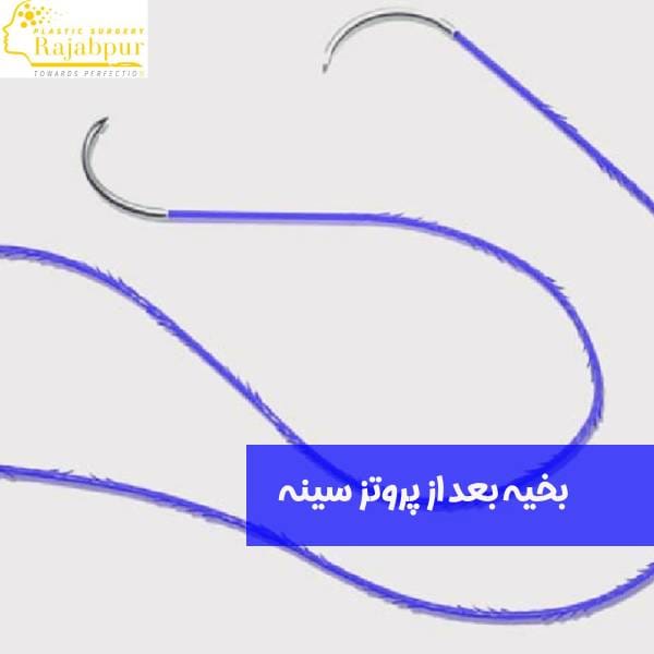 بخیه پروتز سینه