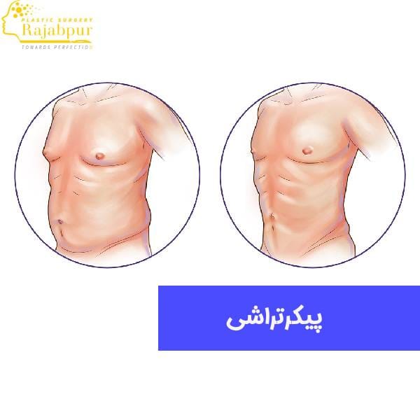 عکس پیکرتراشی