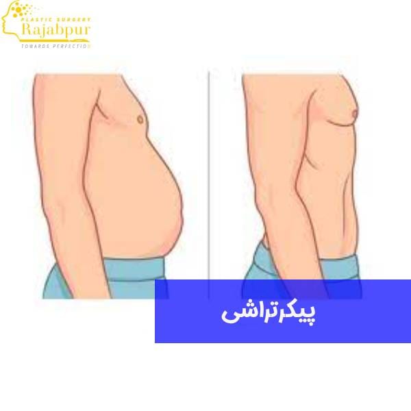 عکس پیکرتراشی