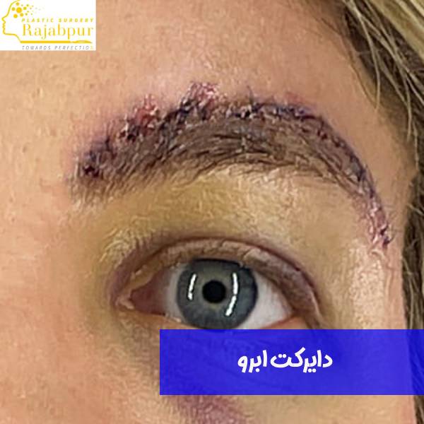 عمل دایرکت ابرو