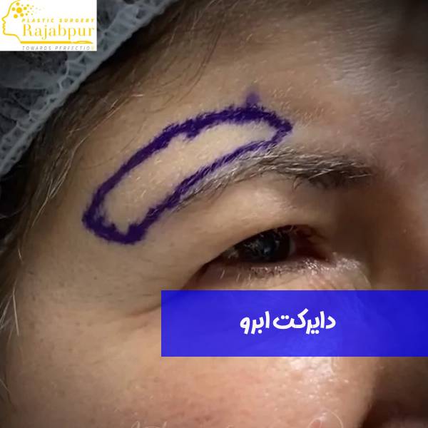 دایرکت ابرو