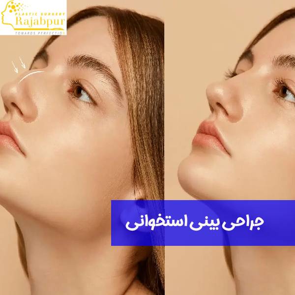 عمل بینی استخوانی