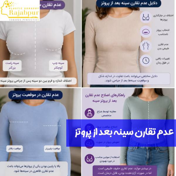 عدم تقارن سینه بعد از پروتز
