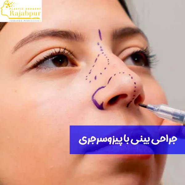 جراحی بینی با پیزوسرجری