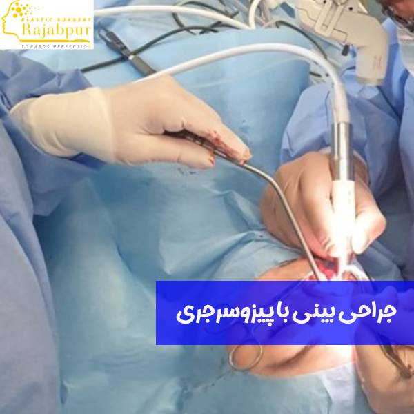 جراحی بینی با پیزوسرجری